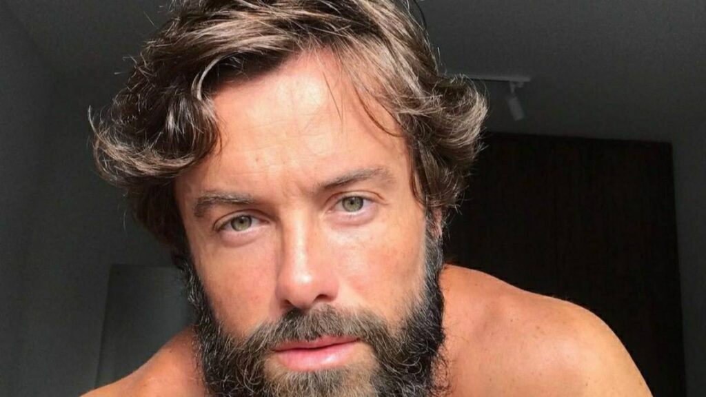 O ator Kayky Brito foi atropelado no Rio de Janeiro e esta em estado grave. 1