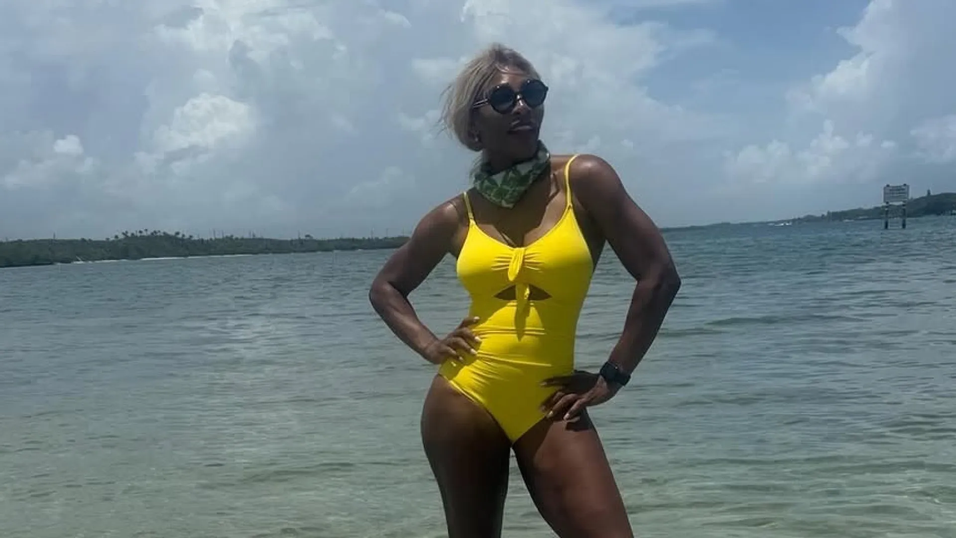 Serena Williams diz ter eliminado 14 kg com uso de medicamento GLP-1 após segunda gravidez - Imagem do artigo