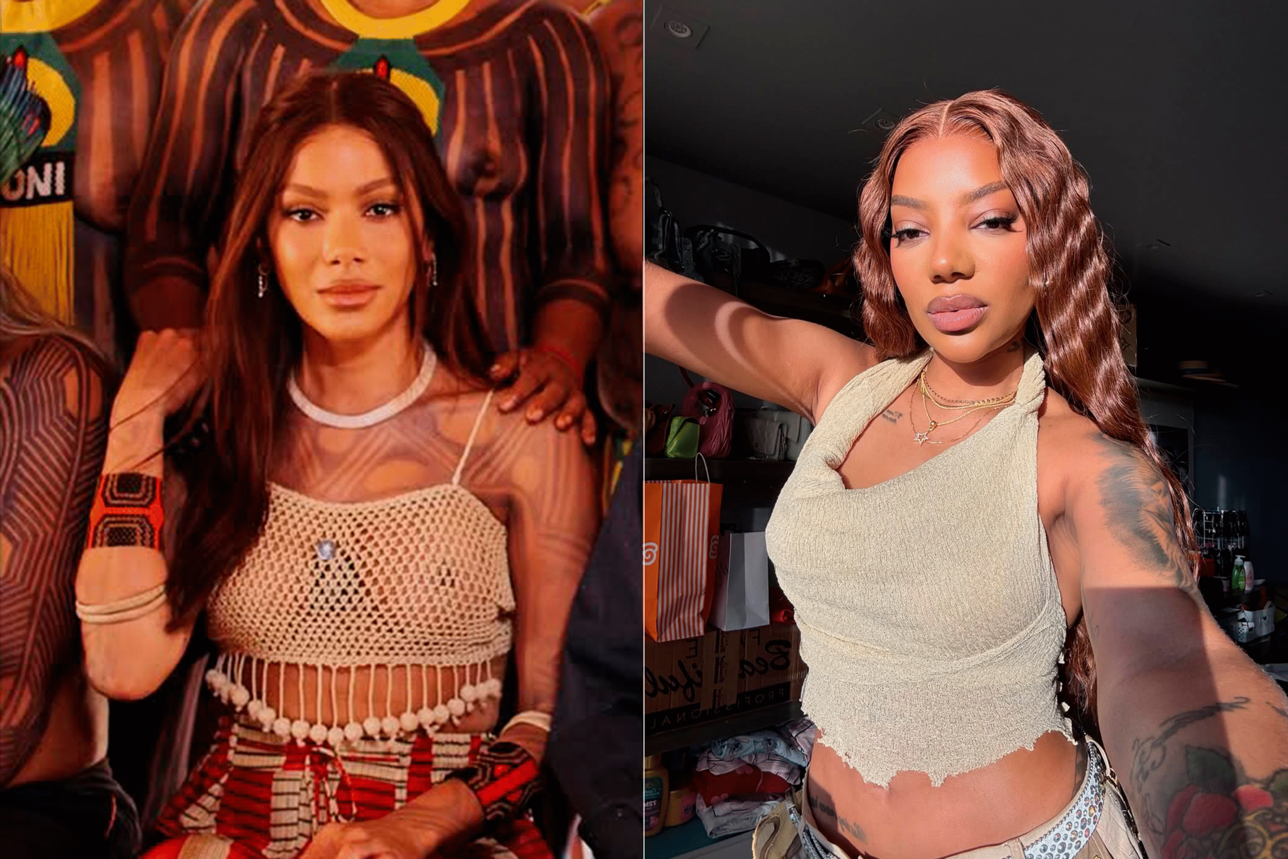 Mudança facial de Anitta reacende discussão sobre padrão de beleza entre famosos - Imagem do artigo original