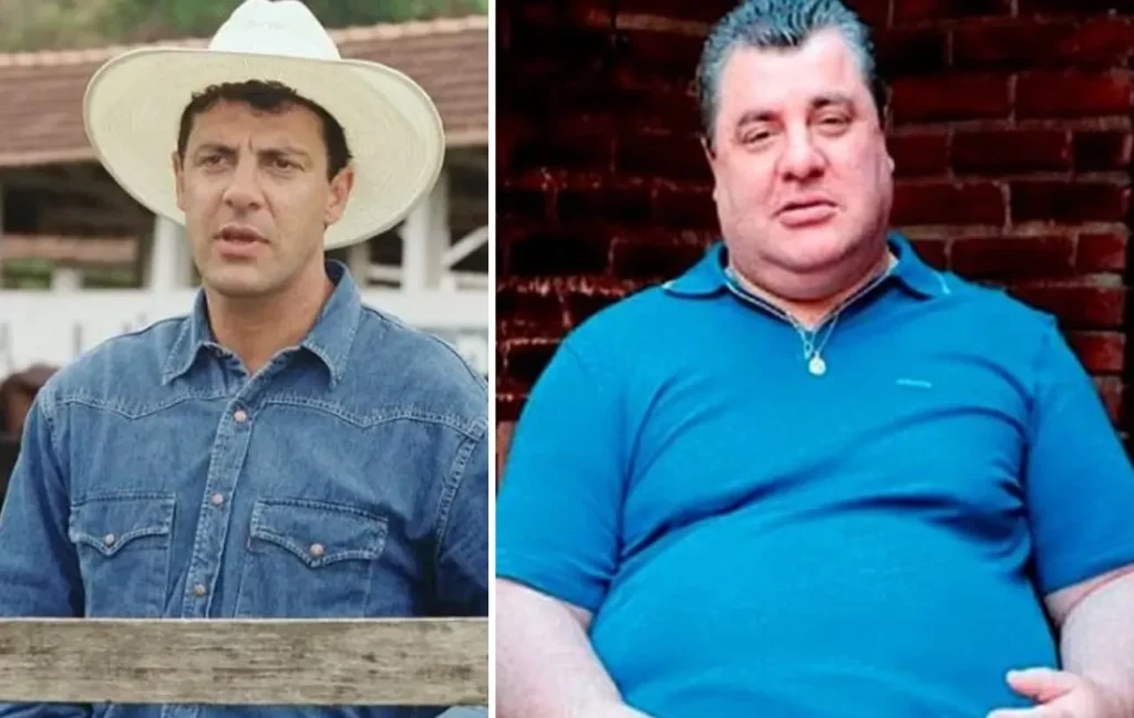 antes e depois gerson brenner