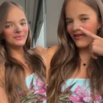 rafaella justus mostra resultado do nariz apos cirurgia veja 1708361654